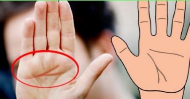 Palmistry If you also have Y mark in your hand then definitely read here