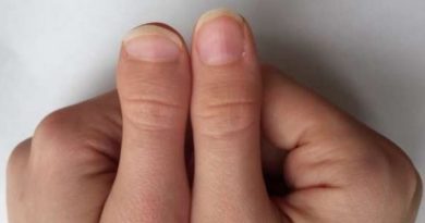 Palmistry The size of thumb tells about your personality