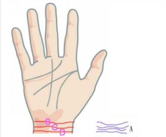 Palmistry- Your palm tells much about your pregnancy problems
