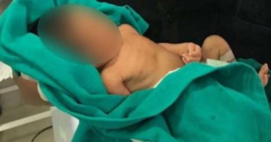 10-month-old baby also turns out to be Corona positive in Karnataka, quarantine 6 people from same family