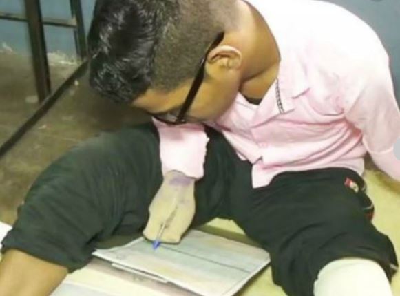 Gujarat A student who lost his hands and feet in accident took the exam in class 12th by writing with elbow, had scored 81% marks in class 10th.