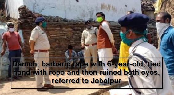 Damoh- barbaric rape with 6-year-old, tied hand with rope and then ruined both eyes, referred to Jabalpur