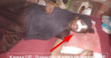 Kanpur UP - On Suspicion of wife's character husabnd cuts off her nose with a knife!