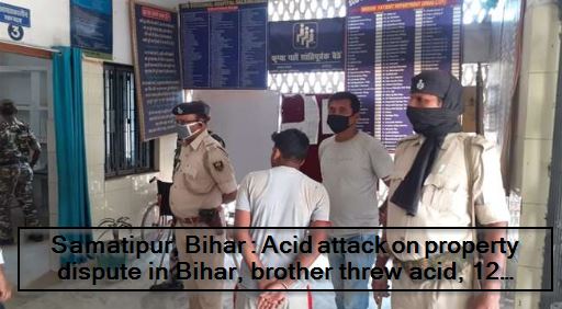 Samatipur, Bihar - Acid attack on property dispute in Bihar, brother threw acid, 12 scorched