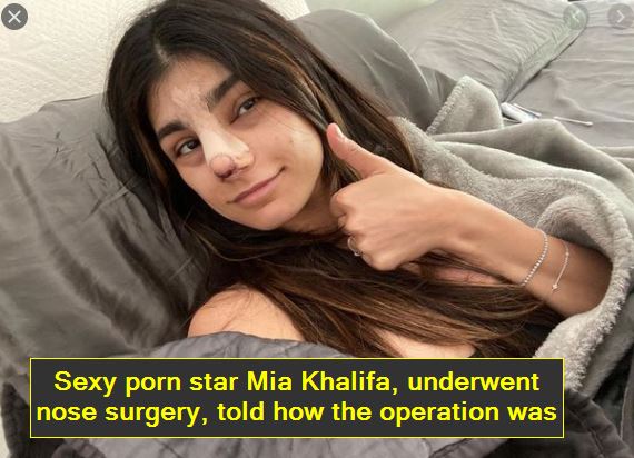 Sexy porn star Mia Khalifa, underwent nose surgery, told how the operation was