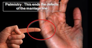 Palmistry - This ends the defects of the marriage line