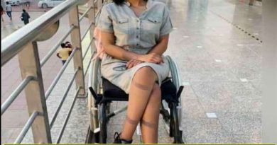 Punjab's 'Pratishtha' reached Oxford, know the unique story of this physically disabled Girl