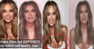 Khloe Kardashian's filter fail EXPOSED