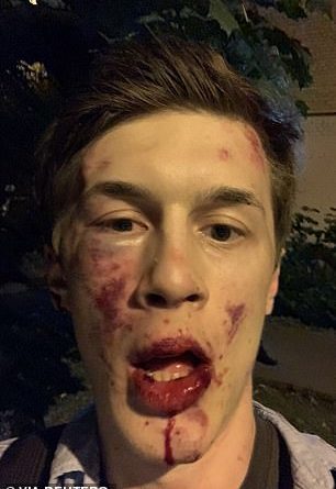 Russian opposition activist Yegor Zhukov was badly beaten outside his home in Moscow