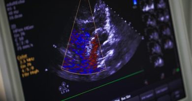 Doctors can often miss female cardiac issues because they do not show up like those suffered by men (stock image of heart scan)