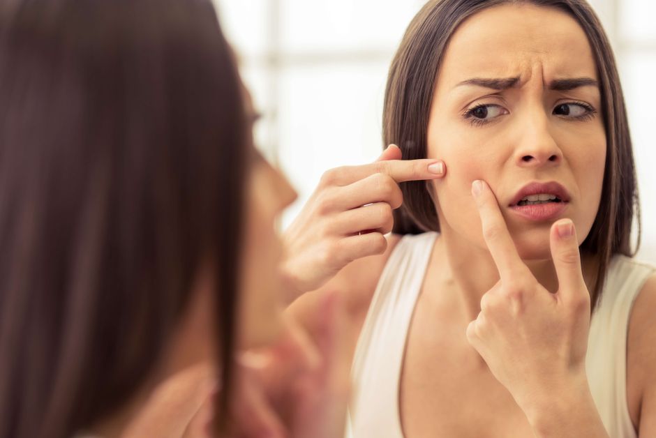 How to prevent pimples caused by sweating | The NY Journal