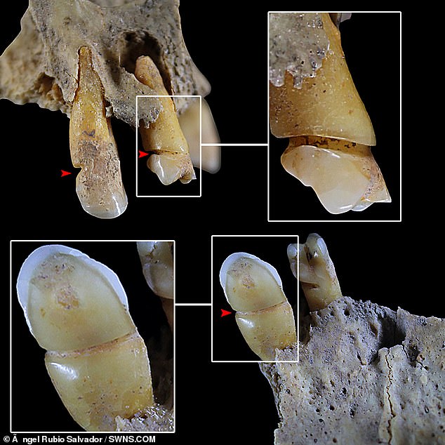 Ancient Spanish women used their teeth for textile work, study says