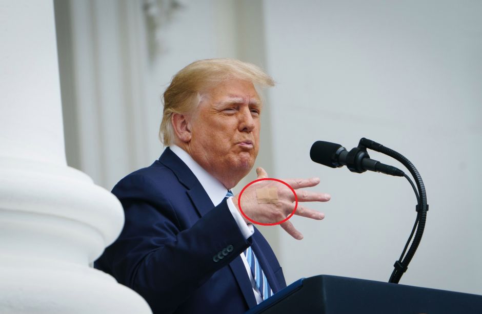 Band-Aids on Trump’s Right Hand Suggest He Is Still Receiving COVID-19 Treatment | The NY Journal