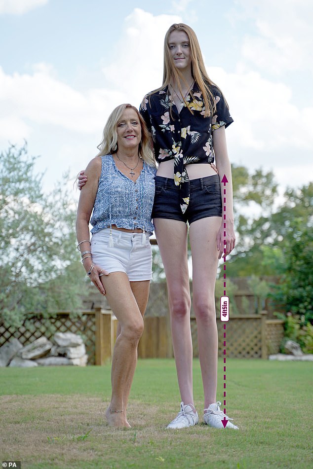 That’s pin-credible! Woman, 17, who stands tall at 6ft 10in has the longest legs in the world
