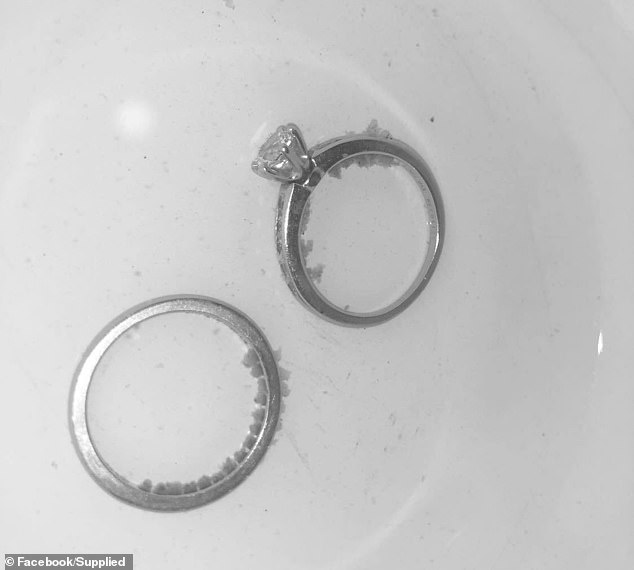 The shocking photo that proves you should be washing your ‘clean’ rings MUCH more often