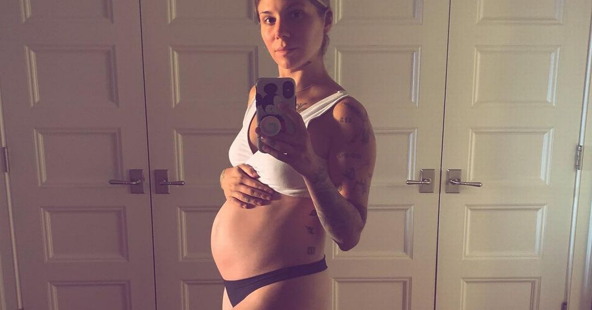 Pregnant Christina Perri says her baby will need surgery after birth