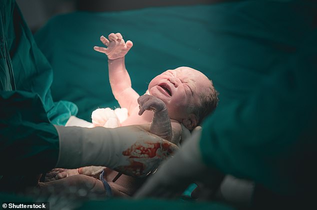 A caesarean section, or C-section, interferes with a baby's ability to obtain beneficial germs from the mother's microbiome. Pictured, medical staff pull a new born baby from a mother via C-section