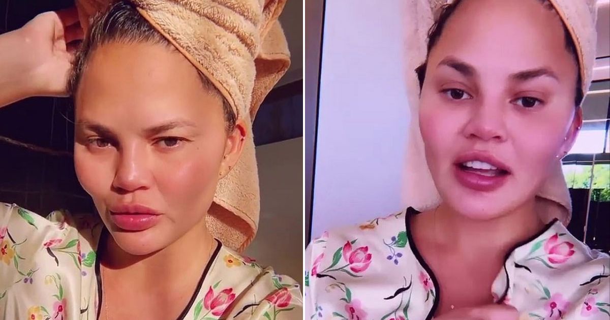 Chrissy Teigen feels ‘really good’ as she takes first shower in two months