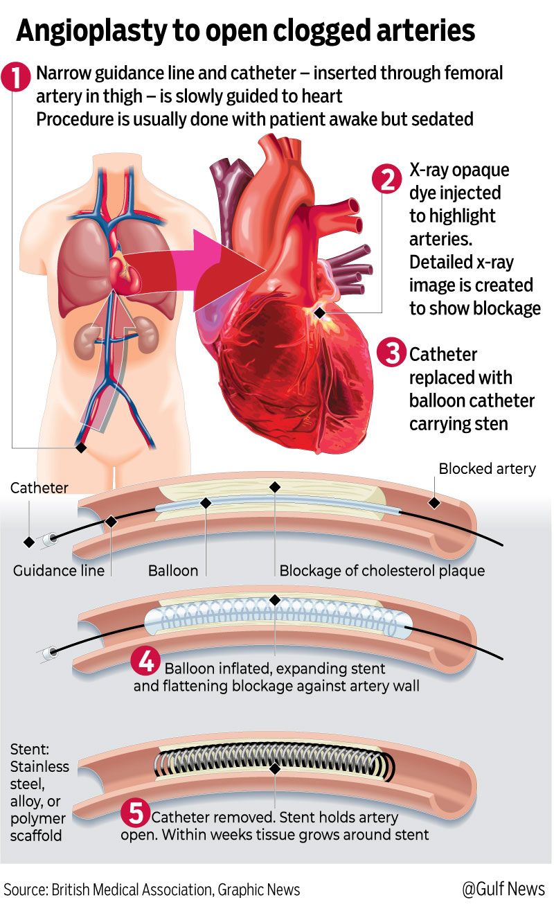 uae-how-to-know-if-you-re-having-a-heart-attack-the-state