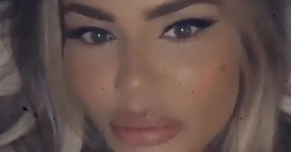 Chloe Sims hits back over vicious claims she’s had ‘too much’ face surgery