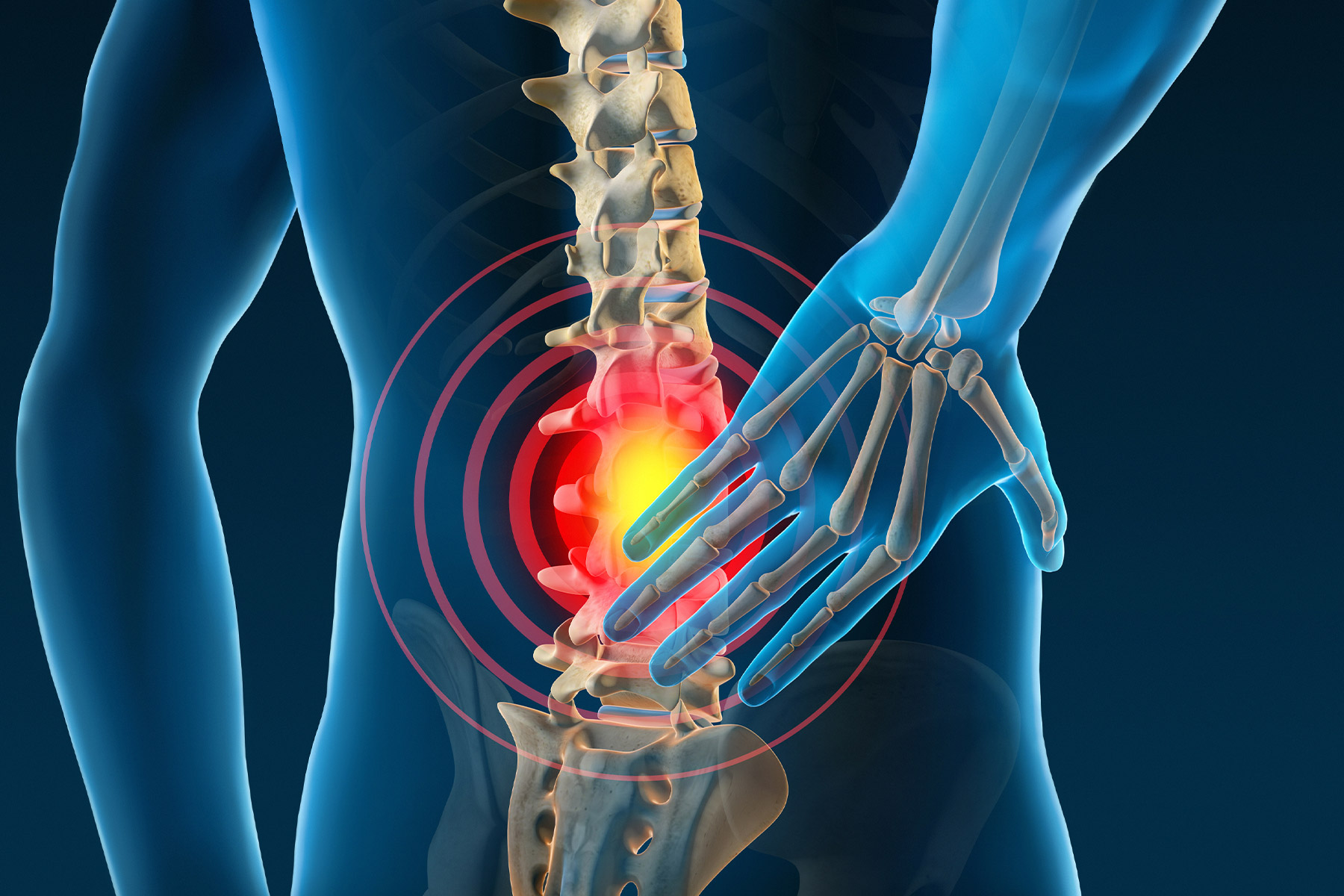 6 Ways to Improve Your Back Pain