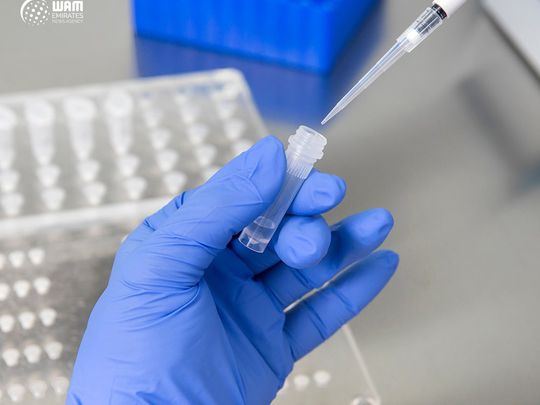 What you need to know about the Russian COVID-19 vaccine Phase III trials in the UAE