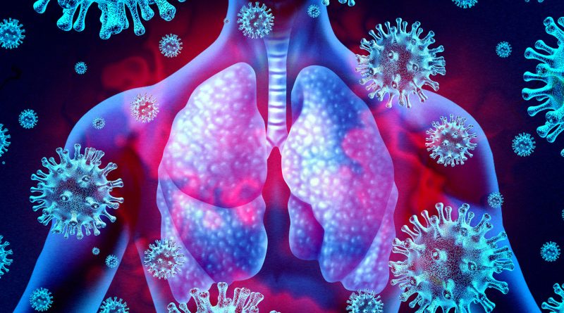 Research Shows Why COVID Pneumonia Is More Deadly