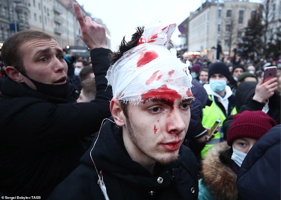 A supporter's face is bandaged and covered in blood after attending the unauthorised rally in Moscow on Saturday