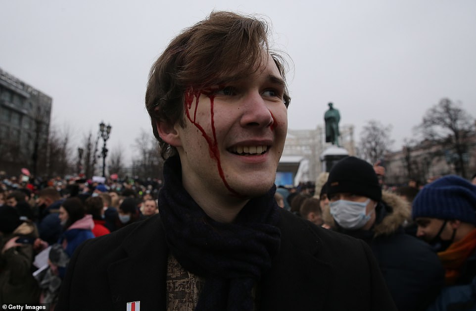 An injured participant reacts during an unauthorised protest rally against of jailing of opposition leader Alexei Navalny