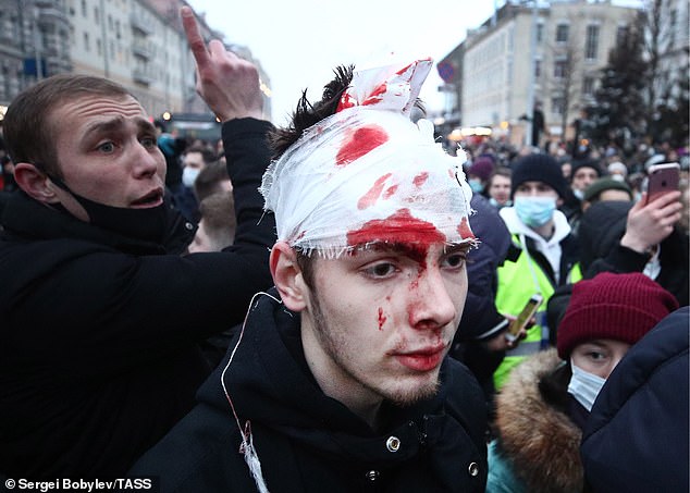 A supporter's face is bandaged and covered in blood after attending the unauthorised rally in Moscow on Saturday