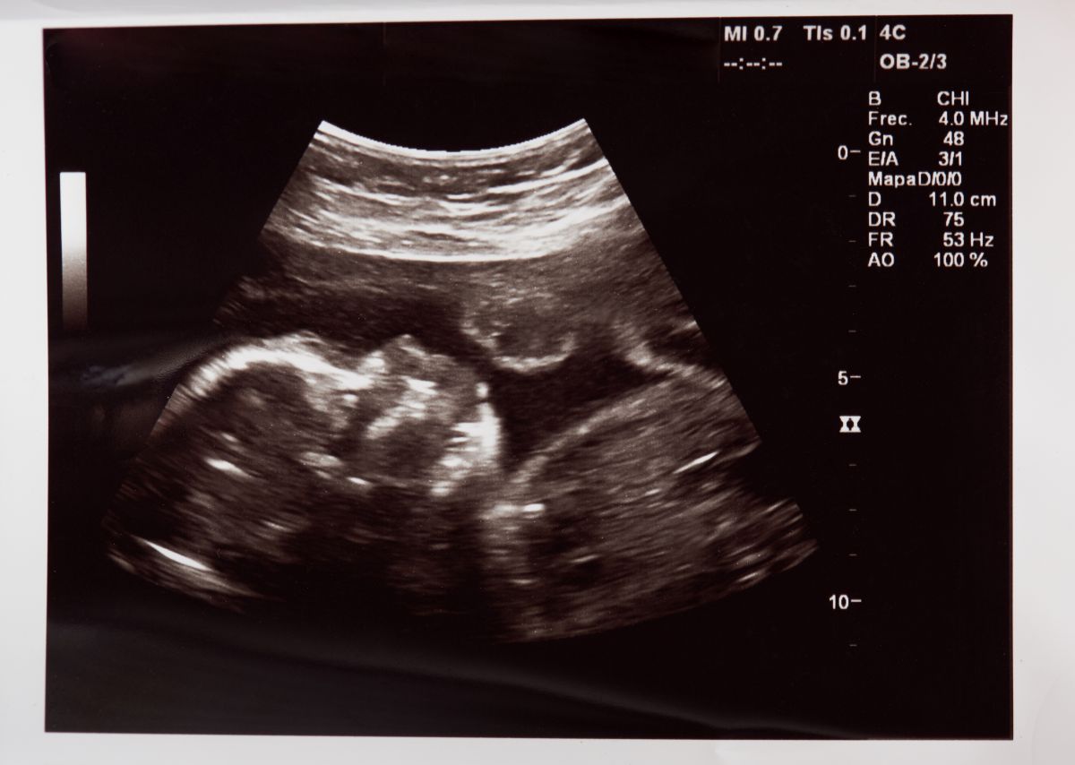 Baby does the unthinkable during ultrasound | The State