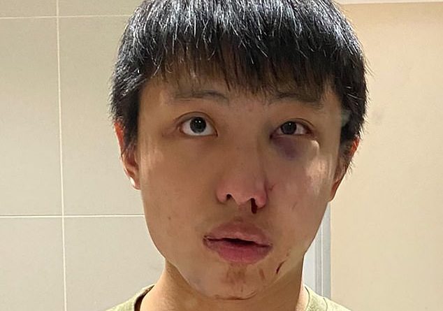 Teenager, 15, shouted at Singapore law student ‘I don’t want your coronavirus in my country’
