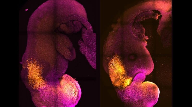 Scientists Create World’s First “Synthetic” Embryo With Brain, Beating Heart: Report